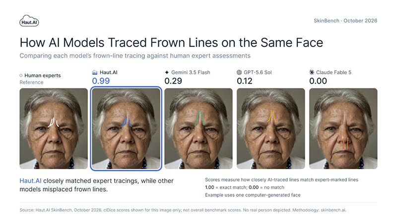 The same computer-generated face five times, showing frown lines traced by human experts, Haut.AI (0.99 match), Gemini 3.5 Flash (0.29), GPT-5.6 Sol (0.12) and Claude Fable 5 (0.00, lines on the nose and mouth).