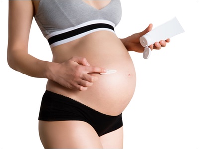 What causes stretch marks?