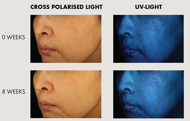 Source: The Lubrizol Corporation