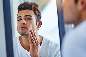 Why is male skin blemish prone and how far can cosmetics brands help?