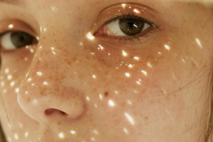 Hyperpigmentation is the hottest topic in ingredient innovation. We discover what’s new