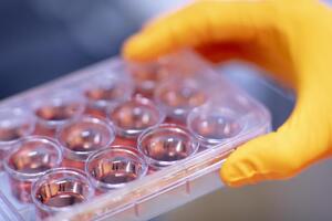 XCellR8 signs licencing deal with SenzaGen to extend Gard animal-free testing 

